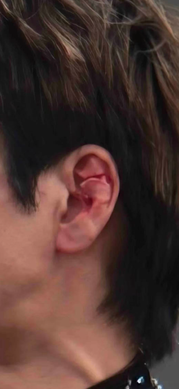 王力宏成都演唱会被束带绊倒，脸部划伤耳部流血，带伤完成整场演出 配图